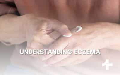 Understanding Eczema: From Causes to Treatment and Everything in Between